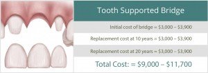 945_tooth-supported-bridge-1024x363